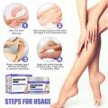 Varicose Vein Treatments Cream Effective Relieve Legs Dilated Vasculitis Phlebitis Natural Formula Ointment For Varicose Veins. 