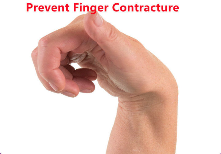 FY%20Adjustable%20Finger%20Orthotics%20Splint%20Finger%20Board%20Hand%20Wrist%20Training%20Support%20Stroke%20Hemiplegia%20Elderly%20Avoid%20Prevent%20Contracture%20Kontraktur%20Jari%20Strok%20Hypertonia%20%E6%89%8B%E6%8C%87%E7%9F%AB%E6%AD%A3%E6%9D%BF%20%E4%B8%AD%E9%A3%8E%E5%BA%B7%E5%A4%8D%E5%9F%B9%E8%AE%AD%20-%20Image%204