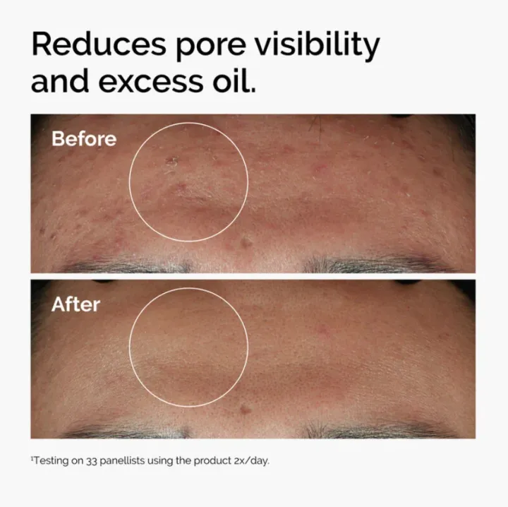 The%20Ordinary%20Niacinamide%2010%25%20+%20Zinc%201%25%2030ml%20-%20Image%203