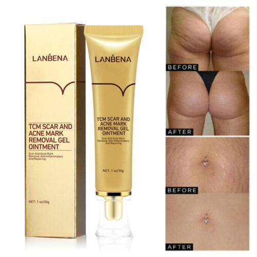 Lanbena%20TCM%20Scar%20And%20Acne%20Mark%20Removal%20Gel%20Ointment%2030G%20-%20Image%204