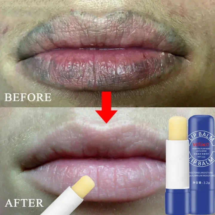 Lip%20Balm%20Remove%20Dark%20Lighten%20Melanin%20Lip%20Mask%20Fade%20Lip%20Line%20Brighten%20Exfoliating%20Moisturize%20Dead%20Skin%20Repair%20Lip%20Care%20Products%20-%20Image%202