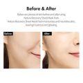 Ricocell Potato Essence Korean Facial Mask Sheet 1Pcs Moisture Face Mask Sheet Skin Care For Women & Men. 
