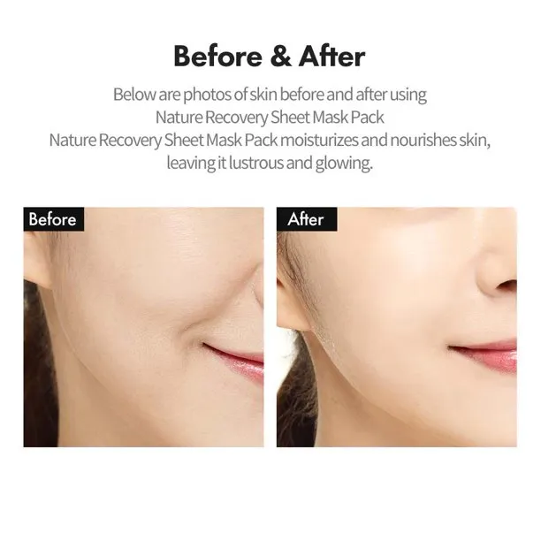 Ricocell%20Potato%20Essence%20Korean%20Facial%20Mask%20Sheet%201Pcs%20Moisture%20Face%20Mask%20Sheet%20Skin%20Care%20For%20Women%20&%20Men%20-%20Image%207