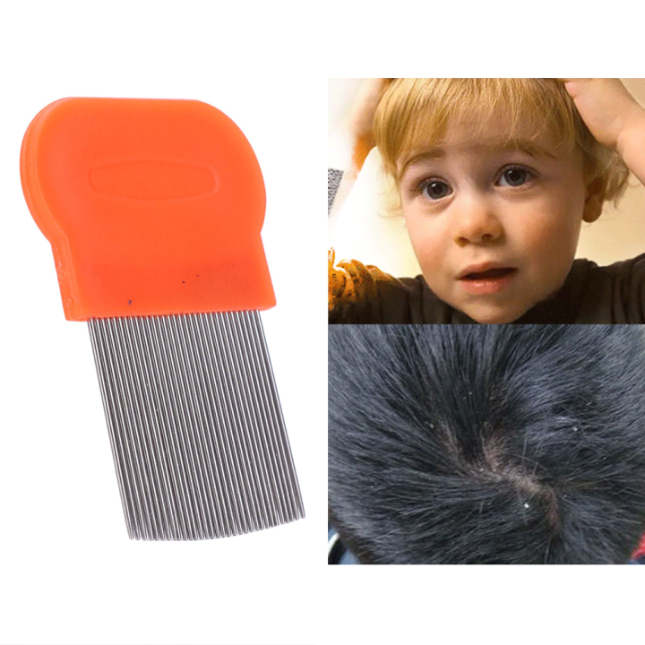 Hair%20Lice%20Comb%20Brushes%20Terminator%20Fine%20Egg%20Dust%20Nit%20Free%20Removal%20Stainless%20Steel%20-%20Image%204
