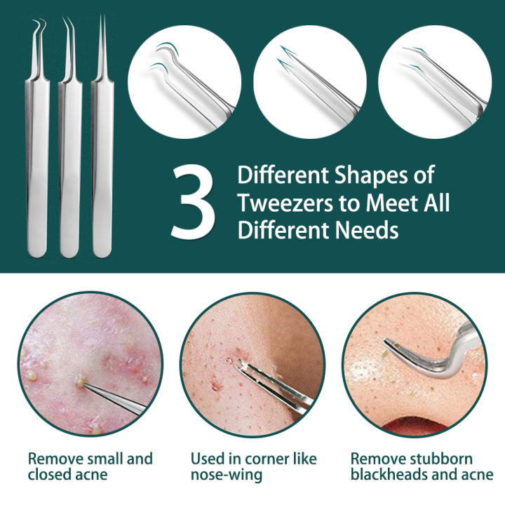 8PCS%20Blackhead%20Remover%20Kit,%20Comedone%20Pimple%20Extractor%20Tool%20Acne%20Removal%20Kit%20Acne%20Needle%20Blemish%20Remover%20Set%20for%20Blackhead,%20Whitehead%20Popping%20with%20Case%20-%20Image%207