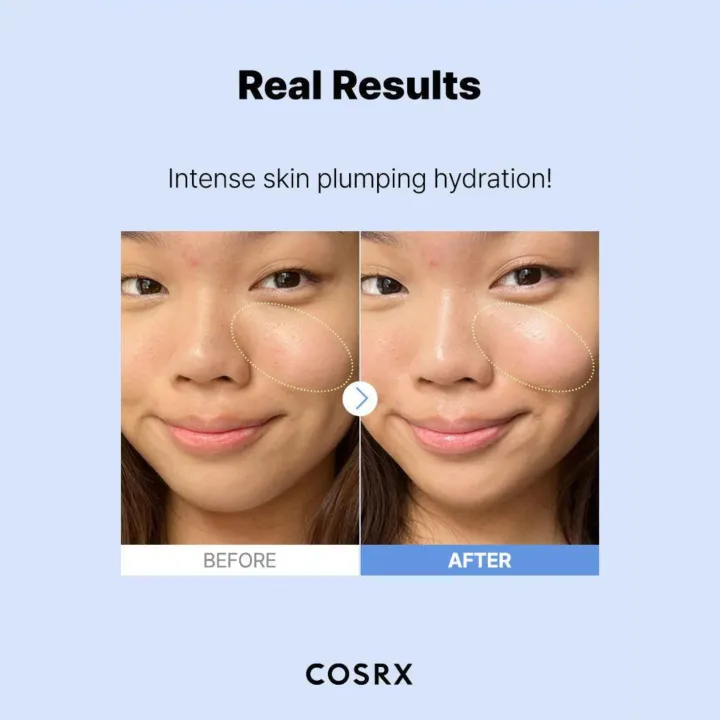 COSRX%20Hyaluronic%20Acid%20Serum%203X%20Moisturizing%20And%20Skin%20Rejuvenation%20Beauty%20Liquid%20for%20Face%20-%20Image%204