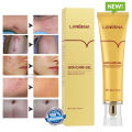 Lanbena TCM Scar And Acne Mark Removal Gel Ointment Cream 30g - Lanbena skin care gel - tcm scar removal gel original  - lanbena tcm scar removal cream. 