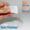 Scar tape, skin wound high-efficiency hand silicone sheet treatment patch, 4x15cm scar patch removal, ear orthosis skin burn repair. 