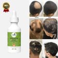 Haryali Hair Regrowth Oil Alopecia Areata Treatment hair care treatment instant hair fall. 