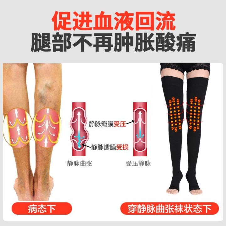 Medical%20Varicosity%20Stretch%20Socks%20Male%20and%20Female%20Secondary%20and%20Tertiary%20Pressure%20Long%20Tube%20Auxiliary%20Relief%20Type%20Anti-Thrombosis%20Spring/Autumn/Summer%20-%20Image%206