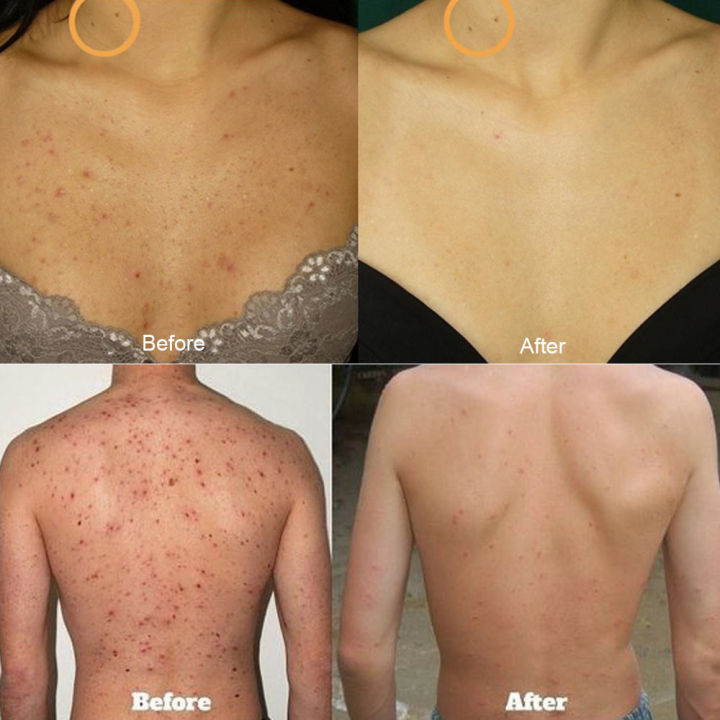 Soap%20Sea%20Salt%20Soap%20Goat%20Milk%20Cleaner%20Removal%20Pimple%20Pores%20Blackheads%20Acne%20Moisturizing%20Face%20Wash%20Handmade%20Soap%20Base%20Makeup%20Tool%20-%20Image%203