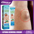 Lipoma Removal Cream Relief Pain Treat Skin Swelling Lipolysis Cellulite Fat Lump Nodule Removal Ointment Anti-tumor Plaster. 