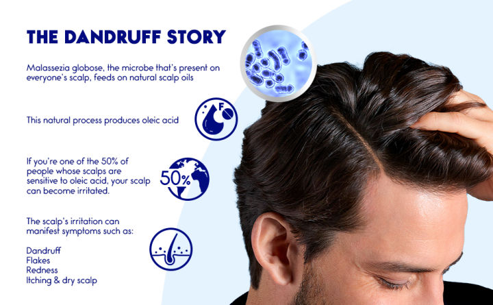 Head%20&%20Shoulders%20Citrus%20Fresh%20Anti-Dandruff%20Shampoo%20-%20400ml%20#DD%20-%20Image%203