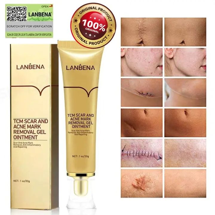 TCM%20All%20New%20Scar%20Cream,%20Acne%20Scar%20Removal%20Cream,%20Skin%20Repair%2030G%20Lanbena%20-%20Image%209