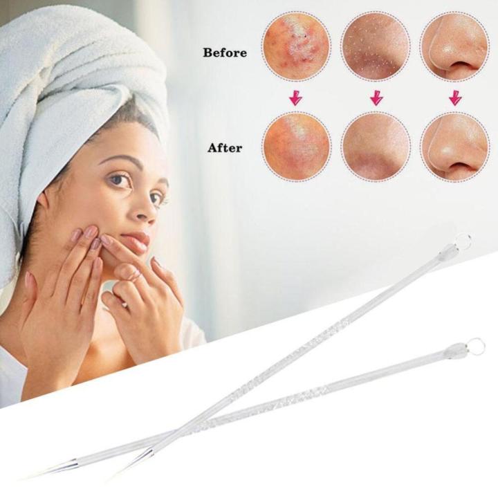 2PCS%20Acne%20Removal%20Needle%20Double%20Side%20Stainless%20Steel%20Skin%20Blackhead%20Remover%20Pimple%20Comedo%20Extractor%20Blackhead%20Pick%20Acne%20Stick%20-%20Image%202