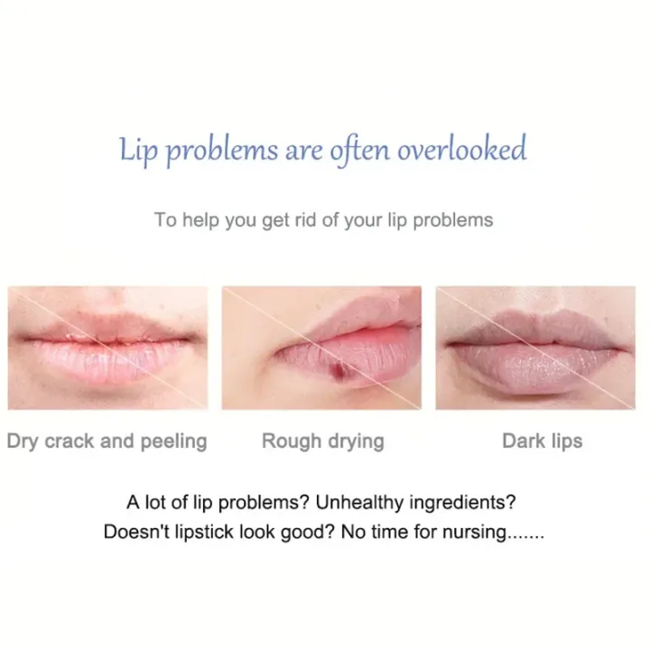 Lip%20Balm%20Remove%20Dark%20Lighten%20Melanin%20Lip%20Mask%20Fade%20Lip%20Line%20Brighten%20Exfoliating%20Moisturize%20Dead%20Skin%20Repair%20Lip%20Care%20Products%20-%20Image%205
