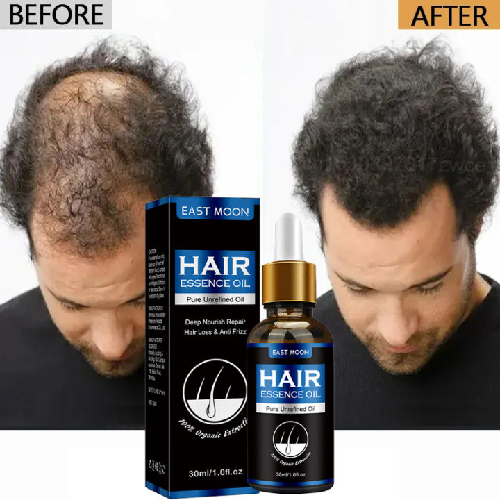 7-day Rapid Hair Growth Essential Oil Hair Regeneration Oil Anti-hair Loss Mild Repairs Hereditary Hair Essential Oil New
