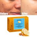 100g Turmeric Whitening Soap Remove Acne Clean Oily Care Aging Body Soap Medicine Anti Chinese Handmade Ingredients Skin Na R3G6. 