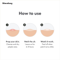 Wenefang Fifty percent discount Chin Acne Pimple Patch Sticker Acne Treatment Pimple Remover Tool Blemish Spot Face Repair Patch Skin Care Waterproof 36 Patches. 