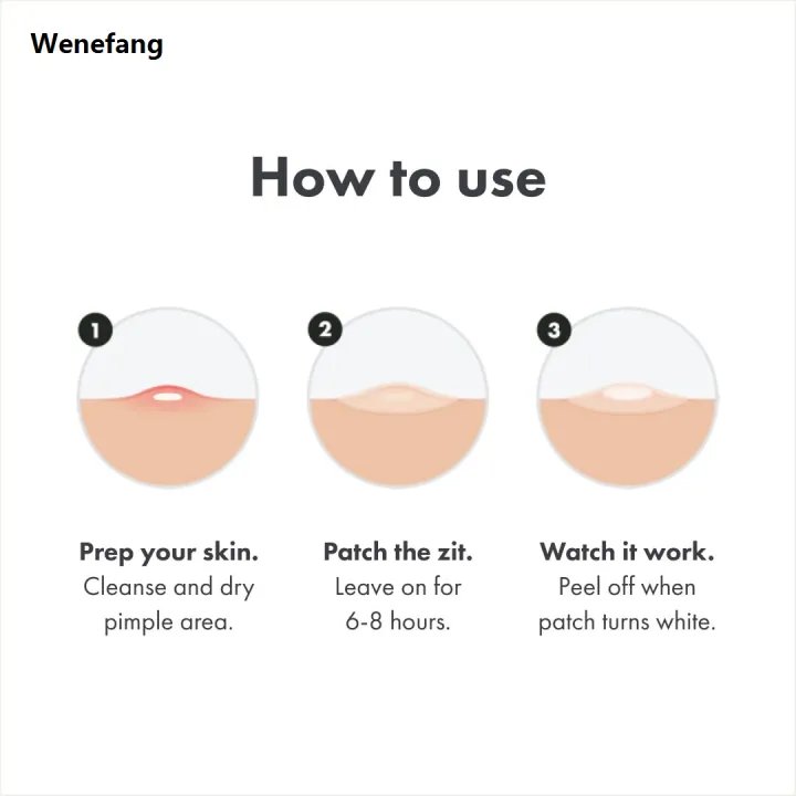 Wenefang%20Fifty%20percent%20discount%20Chin%20Acne%20Pimple%20Patch%20Sticker%20Acne%20Treatment%20Pimple%20Remover%20Tool%20Blemish%20Spot%20Face%20Repair%20Patch%20Skin%20Care%20Waterproof%2036%20Patches%20-%20Image%206