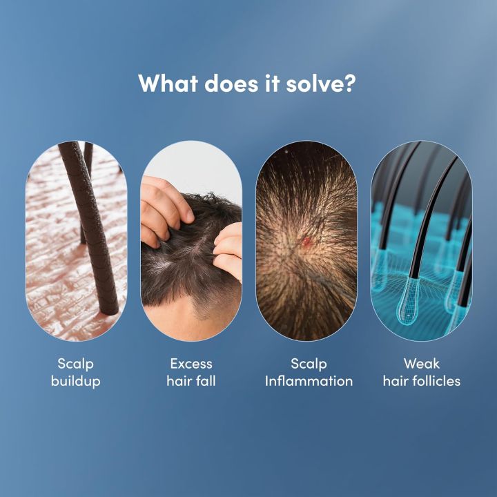 Man%20Matters%20DHT%20Blocking%20Anti%20Hair%20Fall%20Shampoo%20200ml%20%7C%20Paraben%20&%20Sulphate%20Free%20%7C%20With%201%25%20Saw%20Palmetto,%20Biotin,%20Caffeine%20&%20Argan%20Oil%20%7C%20No%20Side%20Effects%20-%20Image%202