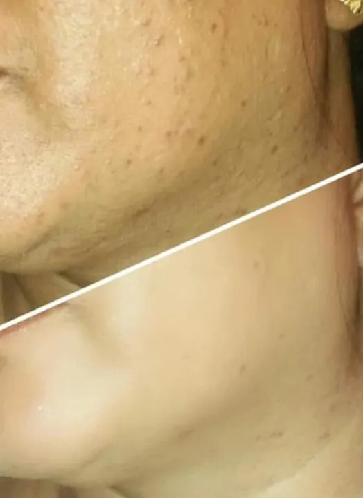 RDL%20Babyface%20Astringent%20with%20Melawhite%201%2060ML%20-%20Image%203