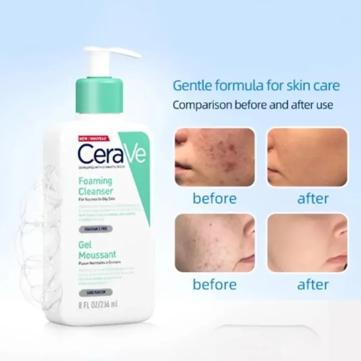 CeraVe%20Foaming%20Cleanser%20Normal%20to%20Oily%20Skin%20236ml%20-%20Image%202