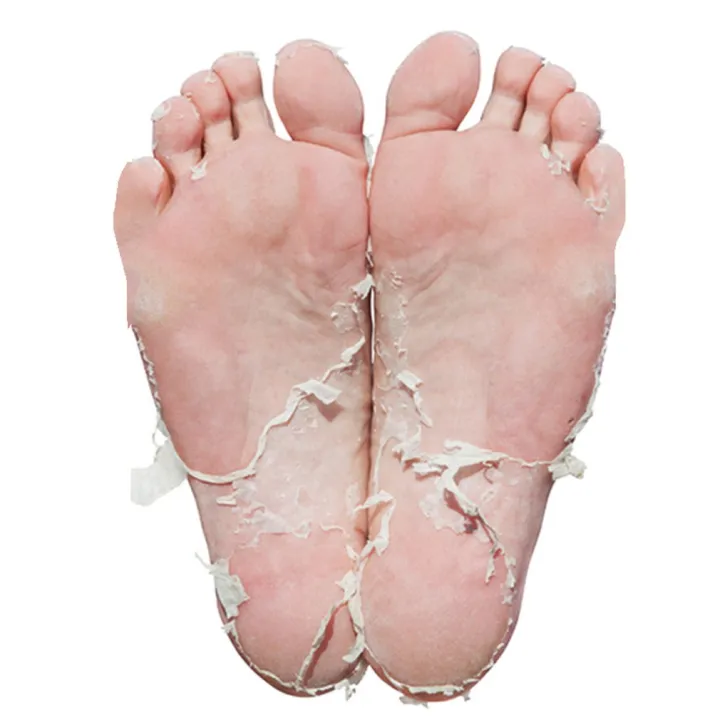 （NEW）Active4U 2Pcs Exfoliating Foot Mask Pedicure Socks Peeling Feet Mask Remove Dead Skin