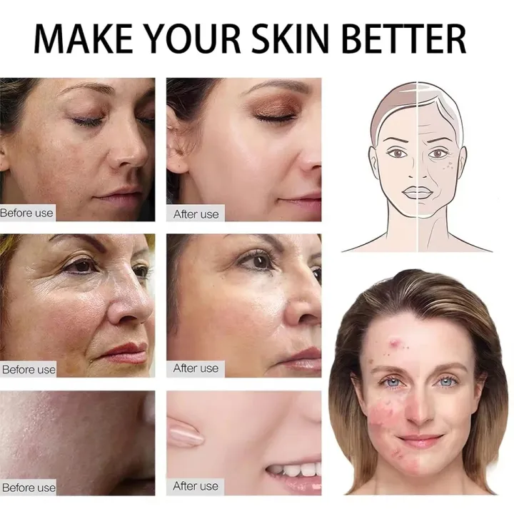 Professional%20Derma%20Roller%20Growth%20&%20Hair%20Regrowth%20Micro%20Needles%20Derma%20Roller%20Anti-Aging%20Skin%20Care%20Beauty%20Tool,Gold%20%20Derma%20Roller%20REAL%20NEEDLES%20%20Microneedles%20Dermaroller%20Micro%20Needle%20Roller%20Microneedling%20Derma%20Needling%20Kit%20-%20Image%208