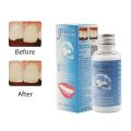 30ML Temporary Tooth Repair Kit Filling Teeth Gaps Moldable False Teeth Solid Glue Denture AdhesiveBasketball. 