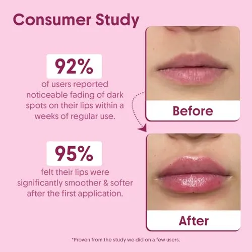 Aravi%20Organic%20Beetroot%20Lip%20Scrub%20with%20Shea%20Butter%20&%20Cocoa%20Butter%20%E2%80%93%20For%20Dark,%20Chapped%20&%20Pigmented%20Lips%20%E2%80%93%20Suitable%20for%20Men%20and%20Women%20%E2%80%93%2015%20gm(FROM%20INDIA)%20-%20Image%202