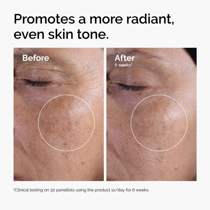 The%20Ordinary%20Glycolic%20Acid%207%25%20Exfoliating%20Toner,%20Brightening%20and%20Smoothing%20Daily%20Toner%20for%20More%20Even-Looking%20Skin%20Tone%20-%20100ml%20-%20Image%202