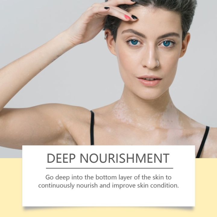 Bee%20Venom%20Vitiligo%20Treatment%20Cream%20Natural%20Relief%20Skin%20Treatment%20Soothing%20White%20Spot%20Removal%20Vitiligo%20Ointment%20Eliminate%20Pigment%20-%20Image%202