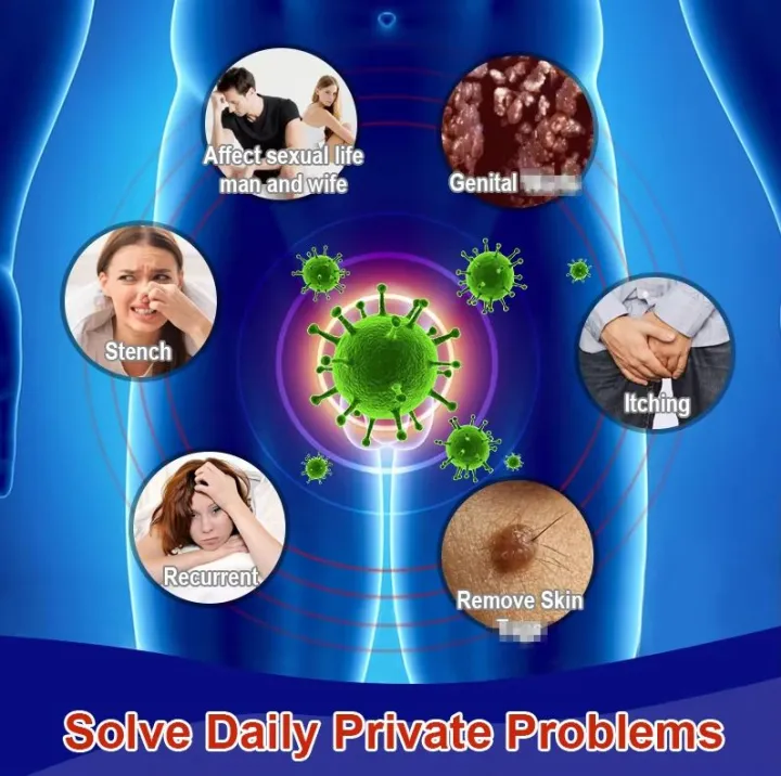 Private%20parts%20warts%20remover%20cream%20with%20natural%20herbal%20ingredients%2020g%20-%20Image%202