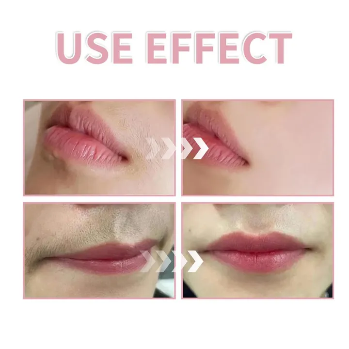 Hair%20Identifier%20Spray%20Dermaplaning%20Spray%20Powder%20For%20Facial%20Hair,%20Moisturizing%20And%20Skin%20Care%20Dermaplaner%20Spray%20For%20Face%20Shav%20V1A2%20-%20Image%206