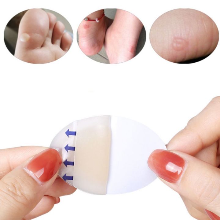 10PCS%20Soft%20Gel%20Shoes%20Sticker%20Hydrocolloid%20Patch%20Blister%20Protector%20Relief%20Pain%20Blisters%20Bunion%20Corrector%20Callus%20Remover%20Foot%20Care%20-%20Image%204