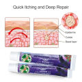 【Fast-selling】 Sumifun 1pcs Skin Care Psoriasis Ointment Treatment Dermatitis Eczema Chinese Herbal Antibacterial Cream Anti Patch.