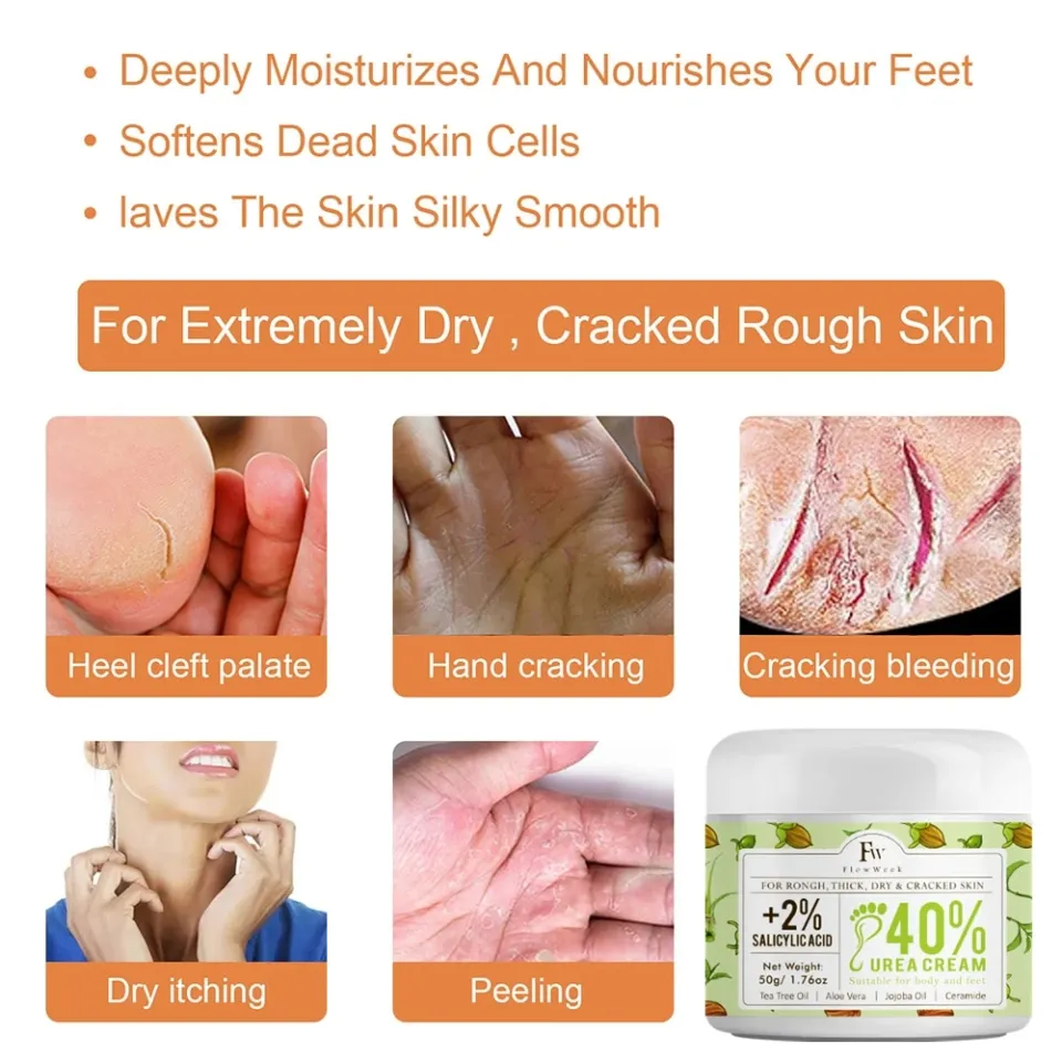 FlowWeek Foot Fungus Removal Cream Relieve Foot Itching Remove