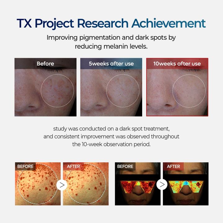 Dr.%20Melaxin%20TX%20Tranexamic%20Acid%2050ml%20-%20Serum%20For%20Fading%20Blemishes%20And%20Melasma%20-%20Image%208