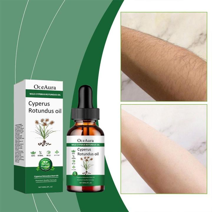 Wenefang Hair Oil: 6otundu, Cypus, Hair Removal, Perus, New CyRotunderus, RS Vegetable Oil, Body Moisturizing, Nourishing, Nourishing, Removing, 0ml