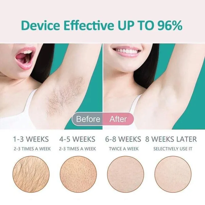 IPL%20Laser%20Hair%20Removal%20Machine%20100W%20Pulse%20Rechargeable%20Female%20Shaver%20%E6%B0%B8%E4%B9%85%E6%80%A7%E6%BF%80%E5%85%89%E9%99%A4%E6%AF%9B%E5%99%A8/Body%20Facial%20Leg%20Dkin%20Hair%20Removal%20Machine%20-%20Image%204