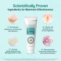 VENUSIA Dr. Reddy's Acne Control Moisturizer I For Oily & Acne Prone Skin I Prevents Acne Breakouts|Oil Free, Non Sticky I 75G (FROM INDIA). 