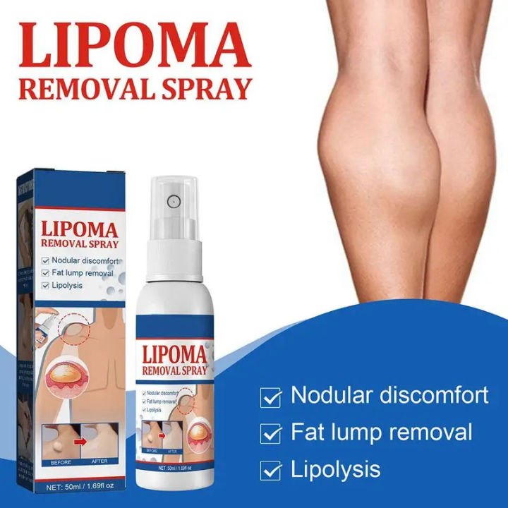 Lipoma%20Removal%20Spray%20Anti%20Tumor%20Skin%20Swelling%20Pain%20Lipolysis%20Cellulite%20Treatment%20Fibroma%20Subcutaneous%20Fat%20Lump%20Relief%20Cream%2050ml%20-%20Image%202