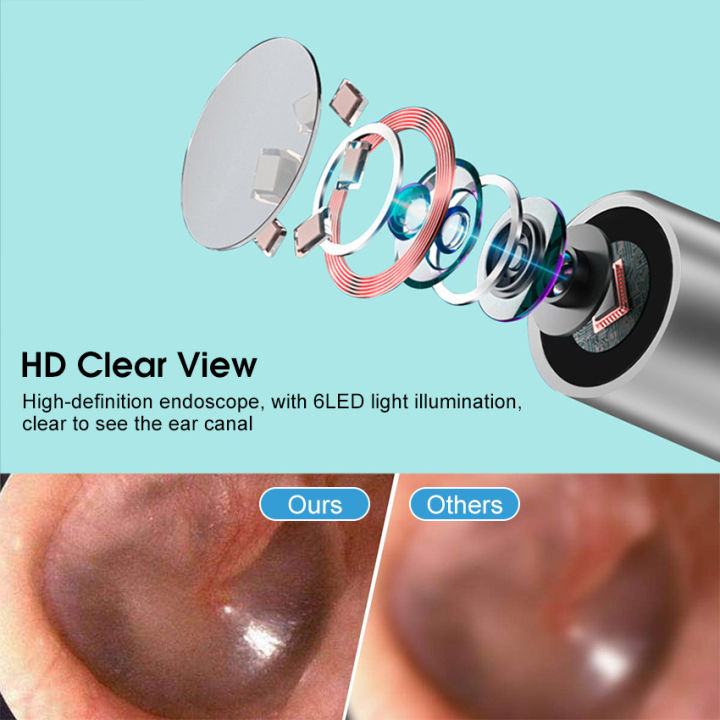 HEGRUS%20Ear%20Pick%20LED%20Flashlight%20Visible%20Ear%20Spoon%20Ear%20Wax%20Removal%20Ear%20Cleaner%20Visual%20Ear%20Scope%20Camera%20Safe%20Ear%20Pick%20Ear%20Cleaning%20Tool%20with%20HD%20Camera%20for%20iPhone,%20iPad%20&%20Android%20Smart%20Phones%20-%20Image%206
