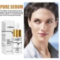 1A5 Face, Nose, Firming Blackheads, Skin Serum Remover, Lanbena Pore Repair Serum, Pore Shrinking, Acne Treatment, Moisturizing, 15ml. 
