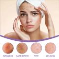 Fade Pimple Mark Cream Anti Acne Blemish Oil Control Shrink Pore Remove Dark Spot Inflammatory Treatment Moisturize Whiten Gel. 