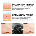 10-60PC Nose Blackhead Remover Strip Deep Cleansing Shrink Pore Acne Black Dots Pore Strips Face Skin Care Patch. 
