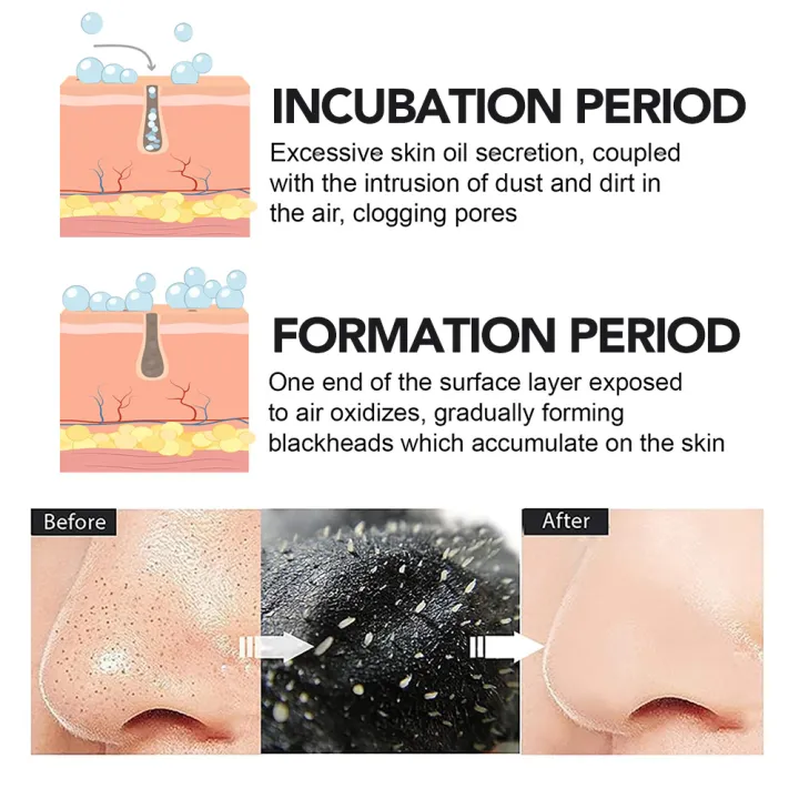 10-60PC%20Nose%20Blackhead%20Remover%20Strip%20Deep%20Cleansing%20Shrink%20Pore%20Acne%20Black%20Dots%20Pore%20Strips%20Face%20Skin%20Care%20Patch%20-%20Image%203