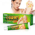 Foot Corn Remover Cream Chicken Eye Skin Infection Treatment Ointment Feet Dead Skin Calluses Removal Tool Health Care 내성발톱. 