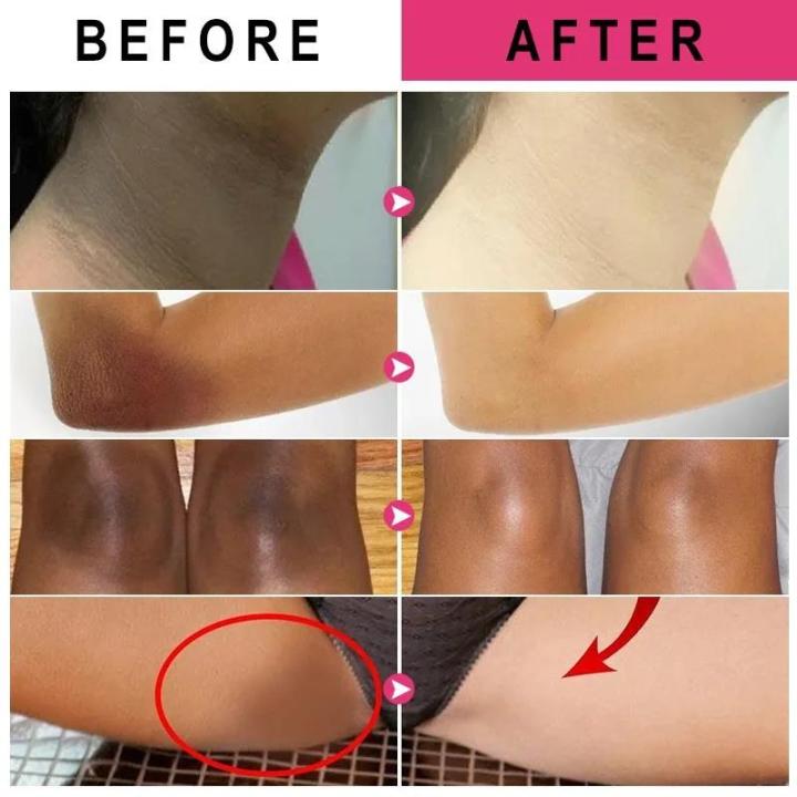 Body%20Brightening%20Cream%20Lightening%20Elbow%20and%20Knee%20Joint%20Black%20Exfoliating%20Cream%20Improving%20Dark%20Inner%20Thigh%20Skin%20Under%20Armpit%20-%20Image%204